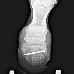 Repair of Coffin Bone Fracture With Screw